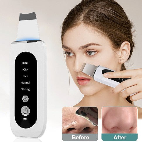 LUMERA™ V-Sonic Pro Ultrasonic Skin Spatula