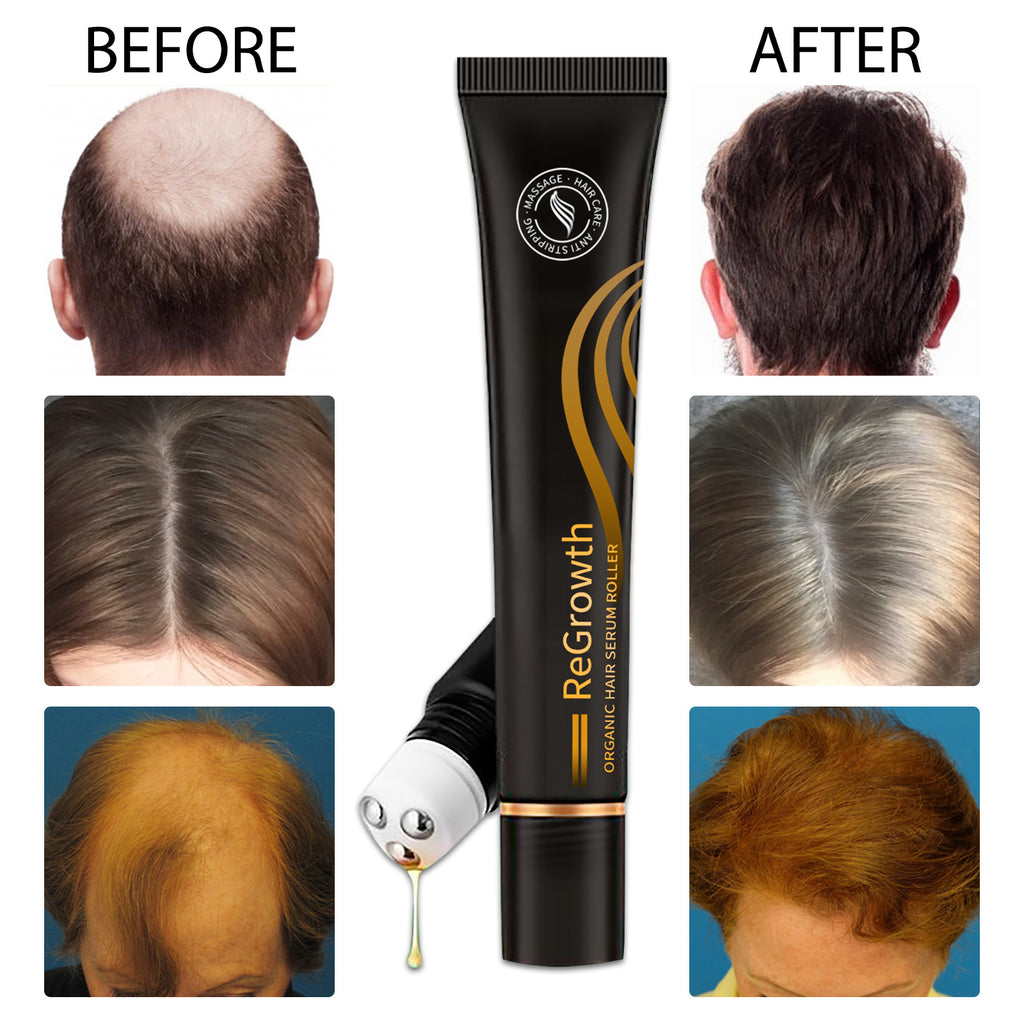 Advanced Hair Revival Serum